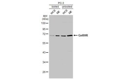 Invitrogen GnRHR Recombinant Rabbit Monoclonal Antibody (HL2638) 100 &mu;L;