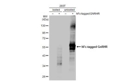 Invitrogen GnRHR Recombinant Rabbit Monoclonal Antibody (HL2638) 100 &mu;L;