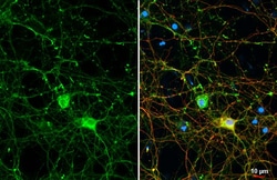 Invitrogen GPM6A Recombinant Rabbit Monoclonal Antibody (HL2473) 100 &mu;L;