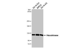 Invitrogen Hexokinase Recombinant Rabbit Monoclonal Antibody (HL2000) 100