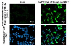 Invitrogen Metapneumovirus Nucleoprotein Recombinant Rabbit Monoclonal