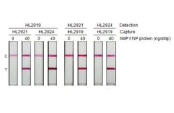 Invitrogen Metapneumovirus Nucleoprotein Recombinant Rabbit Monoclonal
