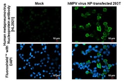 Invitrogen&trade;&nbsp;Metapneumovirus Nucleoprotein Recombinant Rabbit Monoclonal Antibody (HL2921)