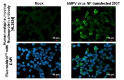 Invitrogen Metapneumovirus Nucleoprotein Recombinant Rabbit Monoclonal