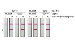 Invitrogen Metapneumovirus Nucleoprotein Recombinant Rabbit Monoclonal