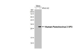 Invitrogen Human Parechovirus 1/3 VP3 (Strain: WA17c-06) Recombinant Rabbit