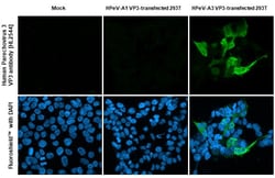 Invitrogen Human Parechovirus 3 VP3 (Strain: WA17c-06) Recombinant Rabbit