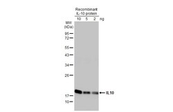 Invitrogen IL-10 Recombinant Rabbit Monoclonal Antibody (HL2897) 100 &mu;L;