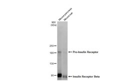 Invitrogen INSR beta Recombinant Rabbit Monoclonal Antibody (HL2737) 100