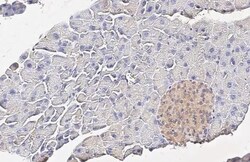 Invitrogen INSR beta Recombinant Rabbit Monoclonal Antibody (HL3132) 100