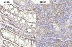 Invitrogen ITGB1 Recombinant Rabbit Monoclonal Antibody (HL1255) 100 &mu;L;