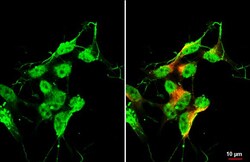 Invitrogen ISL1 Recombinant Rabbit Monoclonal Antibody (HL2807) 100 &mu;L | Buy Online | Invitrogen&trade; | Fisher Scientific