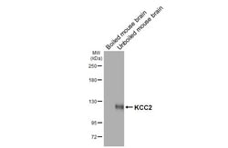 KCC2 Recombinant Mouse Monoclonal Antibody (GT16):Antibodies, Recombinant