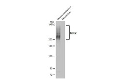 KCC2 Recombinant Rabbit Monoclonal Antibody (HL2535) 100 &mu;L | Buy Online | Invitrogen | Fisher Scientific