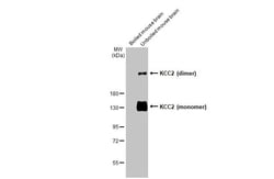 KCC2 Recombinant Rabbit Monoclonal Antibody (HL2535) 100 &mu;L | Buy Online | Invitrogen | Fisher Scientific