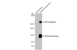 KCC2 Recombinant Rabbit Monoclonal Antibody (HL2625):Antibodies, Recombinant