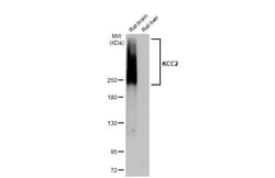 KCC2 Recombinant Rabbit Monoclonal Antibody (HL2625):Antibodies, Recombinant