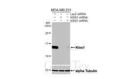 Invitrogen KISS1 Recombinant Rabbit Monoclonal Antibody (HL3043) 100 &mu;L;