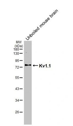 Invitrogen KV1.1 (KCNA1) Recombinant Rabbit Monoclonal Antibody (HL3162)