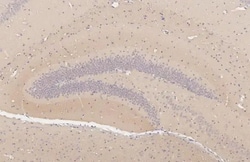 KV1.2 (KCNA2) Recombinant Rabbit Monoclonal Antibody (HL3163):Antikörper