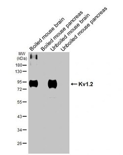 KV1.2 (KCNA2) Recombinant Rabbit Monoclonal Antibody (HL3163):Antikörper