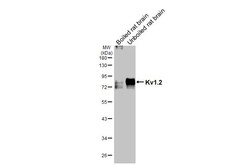 KV1.2 (KCNA2) Recombinant Rabbit Monoclonal Antibody (HL3163):Antikörper