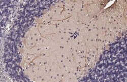 Invitrogen LC3B Recombinant Rabbit Monoclonal Antibody (HL2798) 100 &mu;L;