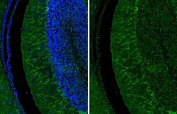 Invitrogen LC3B Recombinant Rabbit Monoclonal Antibody (HL2798) 100 &mu;L;