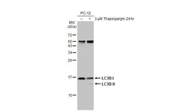 Invitrogen LC3B Recombinant Rabbit Monoclonal Antibody (HL2798) 100 &mu;L;