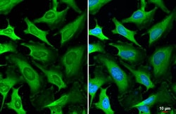Invitrogen LDHA Recombinant Rabbit Monoclonal Antibody (HL2615) 100 &mu;L;
