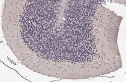 Invitrogen LIM1 Recombinant Rabbit Monoclonal Antibody (HL2774) 100 &mu;L;