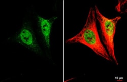 Invitrogen LSM4 Recombinant Rabbit Monoclonal Antibody (HL3172) 100 &mu;L;