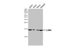 Invitrogen LSM4 Recombinant Rabbit Monoclonal Antibody (HL3172) 100 &mu;L;