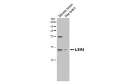 Invitrogen LSM4 Recombinant Rabbit Monoclonal Antibody (HL3172) 100 &mu;L;