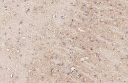 Invitrogen MC4R Recombinant Rabbit Monoclonal Antibody (HL3145) 100 &mu;L;