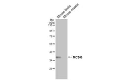 Invitrogen MC5R Recombinant Rabbit Monoclonal Antibody (HL3178) 100 &mu;L;