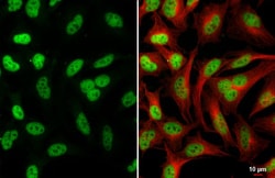 Invitrogen MEF2C Recombinant Rabbit Monoclonal Antibody (HL2811) 100 &mu;L;