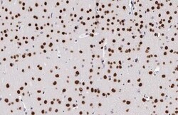 Invitrogen MEF2C Recombinant Rabbit Monoclonal Antibody (HL2811) 100 &mu;L;