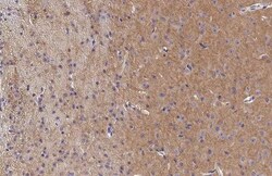 Invitrogen mGluR5 Recombinant Rabbit Monoclonal Antibody (HL2543) 100 &mu;L;