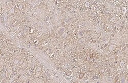 Invitrogen mGluR5 Recombinant Rabbit Monoclonal Antibody (HL2876) 100 &mu;L;