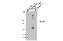 Invitrogen mGluR5 Recombinant Rabbit Monoclonal Antibody (HL2876) 100 &mu;L;