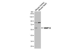 Invitrogen MMP13 Recombinant Rabbit Monoclonal Antibody (HL3067) 100 &mu;L;