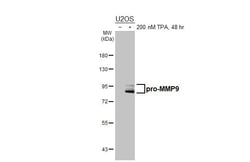 Invitrogen MMP9 Recombinant Rabbit Monoclonal Antibody (HL3239) 100 &mu;L;