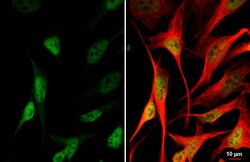 Invitrogen MRE11 Recombinant Mouse Monoclonal Antibody (HL1386-MS) 100