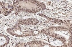 Invitrogen MRE11 Recombinant Mouse Monoclonal Antibody (HL1386-MS) 100