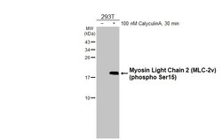 Phospho-MYL2 (Ser15) Recombinant Rabbit Monoclonal Antibody (HL2891):Antibodies,