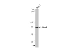 Invitrogen NEK1 Recombinant Rabbit Monoclonal Antibody (HL2489) 100 &mu;L;