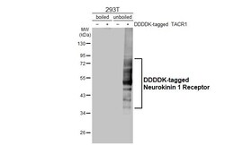 Invitrogen TACR1 Recombinant Rabbit Monoclonal Antibody (HL3195) 100 &mu;L;