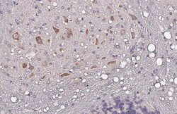 Invitrogen Nucleobindin 1 Recombinant Rabbit Monoclonal Antibody (HL2532)