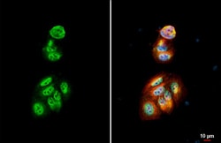 Invitrogen p27Kip1 Recombinant Rabbit Monoclonal Antibody (HL2508) 100